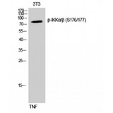 IKK Alpha+Beta Antibody - Western blot of Phospho-IKKalpha/beta (S176/177) antibody