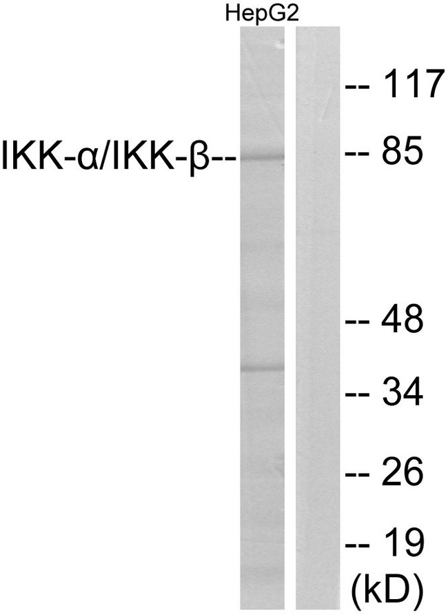 IKK Alpha+Beta Antibody - Western blot analysis of lysates from HepG2 cells, using IKK-alpha/beta Antibody. The lane on the right is blocked with the synthesized peptide.