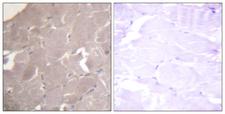 IKK Alpha+Beta Antibody - Immunohistochemistry analysis of paraffin-embedded human skeletal muscle tissue, using IKK-alpha/beta Antibody. The picture on the right is blocked with the synthesized peptide.