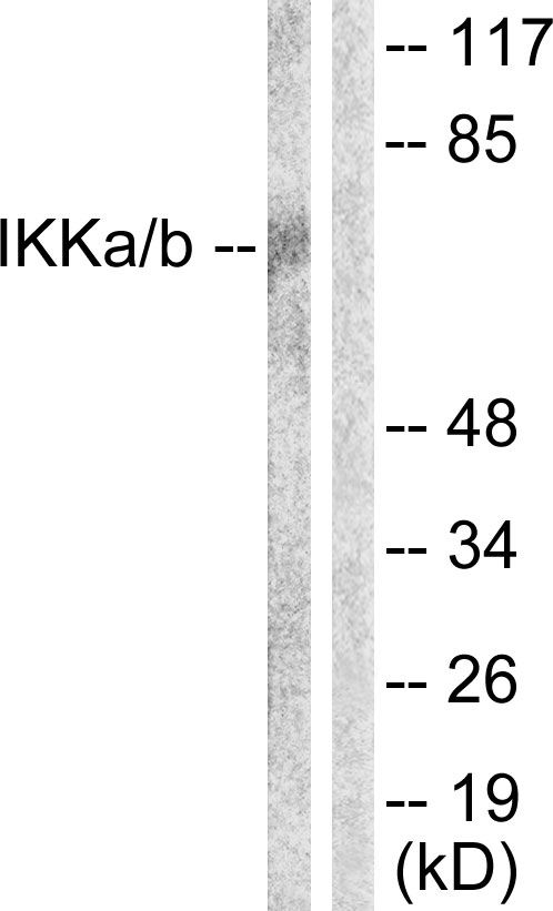 IKK Alpha+Beta Antibody - Western blot analysis of lysates from Jurkat cells, using IKK-alpha/beta Antibody. The lane on the right is blocked with the synthesized peptide.
