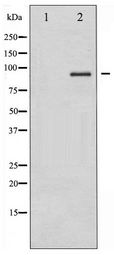 IKK Alpha+Beta Antibody - Western blot of IKK-alpha/beta expression in HepG2 whole cell lysates,The lane on the left is treated with the antigen-specific peptide.