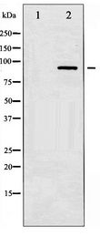 IKK Alpha+Beta Antibody - Western blot of IKK-alpha/beta expression in Jurkat whole cell lysates,The lane on the left is treated with the antigen-specific peptide.