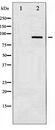 IKK Alpha+Beta Antibody - Western blot of IKK-alpha/beta expression in Jurkat whole cell lysates,The lane on the left is treated with the antigen-specific peptide.