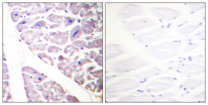 IKK Alpha+Beta Antibody - Immunohistochemistry analysis of paraffin-embedded human heart, using IKK-alpha (Phospho-Ser176) /IKK-beta (Phospho-Ser177) Antibody. The picture on the right is blocked with the phospho peptide.