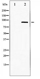 IKK Alpha+Beta Antibody - Western blot of IKK- alpha/ beta phosphorylation expression in TNF treated HepG2 whole cell lysates,The lane on the left is treated with the antigen-specific peptide.