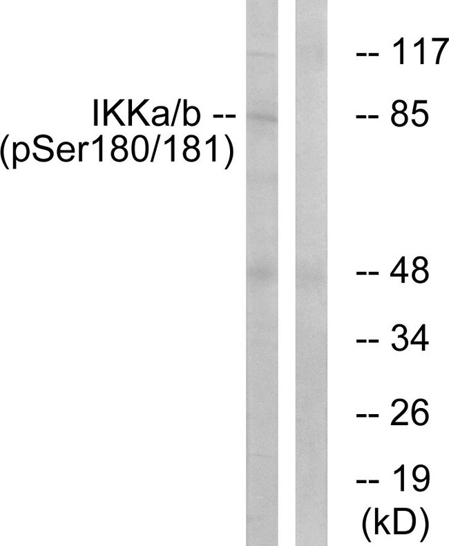 IKK Alpha+Beta Antibody - Western blot analysis of lysates from HepG2 cells treated with TNF 20ng/ml 5', using IKK-alpha/beta (Phospho-Ser180/181) Antibody. The lane on the right is blocked with the phospho peptide.