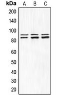 IKK Alpha+Beta Antibody - Western blot analysis of IKK alpha/beta (pS180/181) expression in HEK293T LPS-treated (A); Raw264.7 TNFa-treated (B); PC12 LPS-treated (C) whole cell lysates.