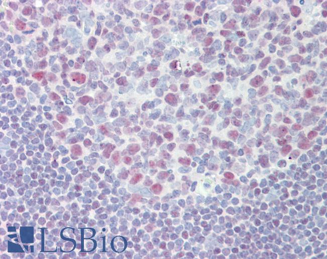 IKZF1 / IKAROS Antibody - Anti-IKZF1 / IKAROS antibody IHC staining of human tonsil. Immunohistochemistry of formalin-fixed, paraffin-embedded tissue after heat-induced antigen retrieval. Antibody concentration 15 ug/ml. This image was taken for the unconjugated form of this product. Other forms have not been tested.