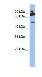 IKZF1 / IKAROS Antibody - IKZF1 antibody Western blot of ACHN lysate. This image was taken for the unconjugated form of this product. Other forms have not been tested.