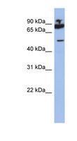 IKZF1 / IKAROS Antibody - IKZF1 antibody Western blot of ACHN lysate. This image was taken for the unconjugated form of this product. Other forms have not been tested.