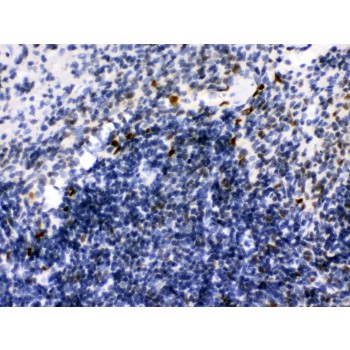 IKZF1 / IKAROS Antibody - Ikaros antibody IHC-paraffin. IHC(P): Mouse Spleen Tissue.