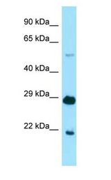 IKZF1 / IKAROS Antibody - IKZF1 / IKAROS antibody Western Blot of Mouse Heart.  This image was taken for the unconjugated form of this product. Other forms have not been tested.
