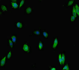 IKZF1 / IKAROS Antibody - Immunofluorescent analysis of Hela cells diluted at 1:100 and Alexa Fluor 488-congugated AffiniPure Goat Anti-Rabbit IgG(H+L)