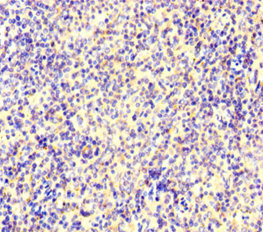 IKZF1 / IKAROS Antibody - Immunohistochemistry of paraffin-embedded human spleen tissue at dilution of 1:100