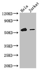 IKZF1 / IKAROS Antibody - Western Blot Positive WB detected in:Hela whole cell lysate,Jurkat whole cell lysate All Lanes: IKZF1 antibody at 3.4ug/ml Secondary Goat polyclonal to rabbit IgG at 1/50000 dilution Predicted band size: 58,49,48,44,42,32,53,25 kDa Observed band size: 58 kDa