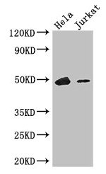 IKZF1 / IKAROS Antibody - Western Blot Positive WB detected in: Hela whole cell lysate, Jurkat whole cell lysate All lanes: IKZF1 antibody at 3.4µg/ml Secondary Goat polyclonal to rabbit IgG at 1/50000 dilution Predicted band size: 58, 49, 48, 44, 42, 32, 53, 25 kDa Observed band size: 49 kDa