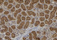 IKZF1 / IKAROS Antibody - 1:100 staining rat kidney tissue by IHC-P. The sample was formaldehyde fixed and a heat mediated antigen retrieval step in citrate buffer was performed. The sample was then blocked and incubated with the antibody for 1.5 hours at 22°C. An HRP conjugated goat anti-rabbit antibody was used as the secondary.