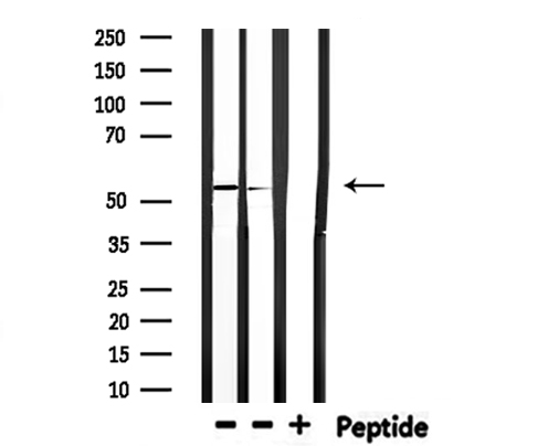 IKZF1 / IKAROS Antibody - Western blot analysis of extracts of HepG2, mouse muscle using IKZF1 antibody.