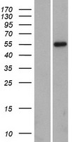 IKZF1 / IKAROS Protein - Western validation with an anti-DDK antibody * L: Control HEK293 lysate R: Over-expression lysate