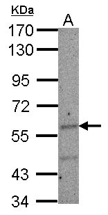 IKZF2 / HELIOS Antibody - Sample (30 ug of whole cell lysate) A: NT2D1 7.5% SDS PAGE IKZF2 / HELIOS antibody diluted at 1:1000