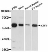 IKZF2 / HELIOS Antibody - Western blot analysis of extracts of various cell lines, using IKZF2 antibody at 1:3000 dilution. The secondary antibody used was an HRP Goat Anti-Rabbit IgG (H+L) at 1:10000 dilution. Lysates were loaded 25ug per lane and 3% nonfat dry milk in TBST was used for blocking. An ECL Kit was used for detection and the exposure time was 1s.