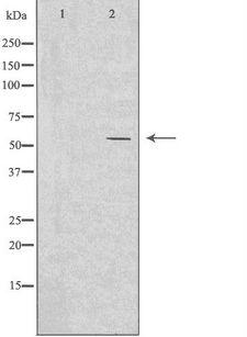 IKZF2 / HELIOS Antibody - Western blot analysis of extracts of HeLa cells using IKZF2 antibody. The lane on the left is treated with the antigen-specific peptide.
