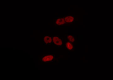 IKZF2 / HELIOS Antibody - Staining HeLa cells by IF/ICC. The samples were fixed with PFA and permeabilized in 0.1% Triton X-100, then blocked in 10% serum for 45 min at 25°C. The primary antibody was diluted at 1:200 and incubated with the sample for 1 hour at 37°C. An Alexa Fluor 594 conjugated goat anti-rabbit IgG (H+L) Ab, diluted at 1/600, was used as the secondary antibody.