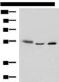 IKZF2 / HELIOS Antibody - Western blot analysis of Human skin tissue A172 cell Human bladder transitional cell carcinoma grade 2-3 tissue lysates  using IKZF2 Polyclonal Antibody at dilution of 1:950