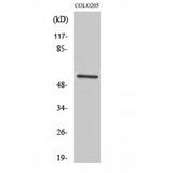 IKZF3 / AIOLOS Antibody - Western blot of Ikaros 3 antibody