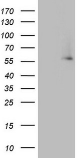 IKZF3 / AIOLOS Antibody - HEK293T cells were transfected with the pCMV6-ENTRY control (Left lane) or pCMV6-ENTRY IKZF3 (Right lane) cDNA for 48 hrs and lysed. Equivalent amounts of cell lysates (5 ug per lane) were separated by SDS-PAGE and immunoblotted with anti-IKZF3.