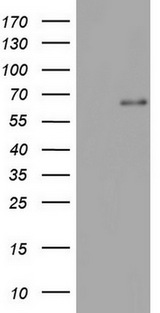 IKZF3 / AIOLOS Antibody - HEK293T cells were transfected with the pCMV6-ENTRY control. (Left lane) or pCMV6-ENTRY IKZF3. (Right lane) cDNA for 48 hrs and lysed. Equivalent amounts of cell lysates. (5 ug per lane) were separated by SDS-PAGE and immunoblotted with anti-IKZF3.