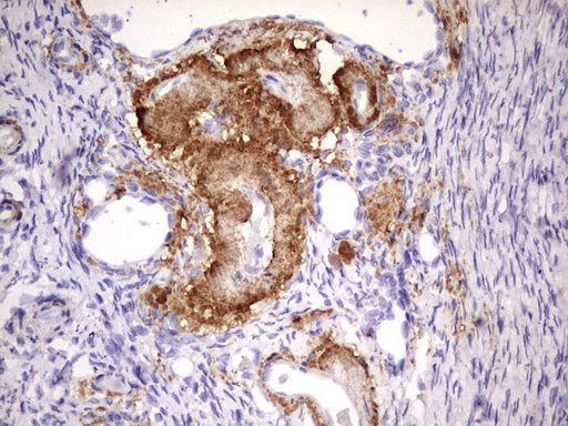 IKZF3 / AIOLOS Antibody - Immunohistochemical staining of paraffin-embedded Human Ovary tissue within the normal limits using anti-IKZF3 mouse monoclonal antibody. (Heat-induced epitope retrieval by 1 mM EDTA in 10mM Tris, pH8.5, 120C for 3min,