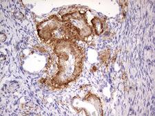 IKZF3 / AIOLOS Antibody - Immunohistochemical staining of paraffin-embedded Human Ovary tissue within the normal limits using anti-IKZF3 mouse monoclonal antibody. (Heat-induced epitope retrieval by 1 mM EDTA in 10mM Tris, pH8.5, 120C for 3min,