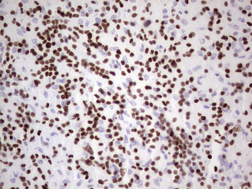 IKZF3 / AIOLOS Antibody - Immunohistochemical staining of paraffin-embedded Human lymph node tissue within the normal limits using anti-IKZF3 mouse monoclonal antibody. (Heat-induced epitope retrieval by 1 mM EDTA in 10mM Tris, pH8.5, 120C for 3min,