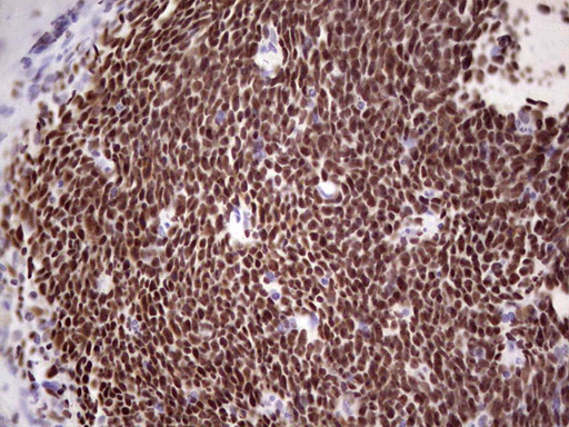 IKZF3 / AIOLOS Antibody - Immunohistochemical staining of paraffin-embedded Human tonsil within the normal limits using anti-IKZF3 mouse monoclonal antibody. (Heat-induced epitope retrieval by 1 mM EDTA in 10mM Tris, pH8.5, 120C for 3min,