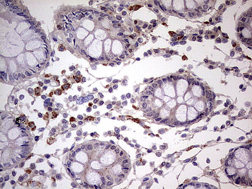 IKZF3 / AIOLOS Antibody - IHC of paraffin-embedded Human colon tissue using anti-IKZF3 mouse monoclonal antibody. (Heat-induced epitope retrieval by 1 mM EDTA in 10mM Tris, pH8.5, 120°C for 3min).