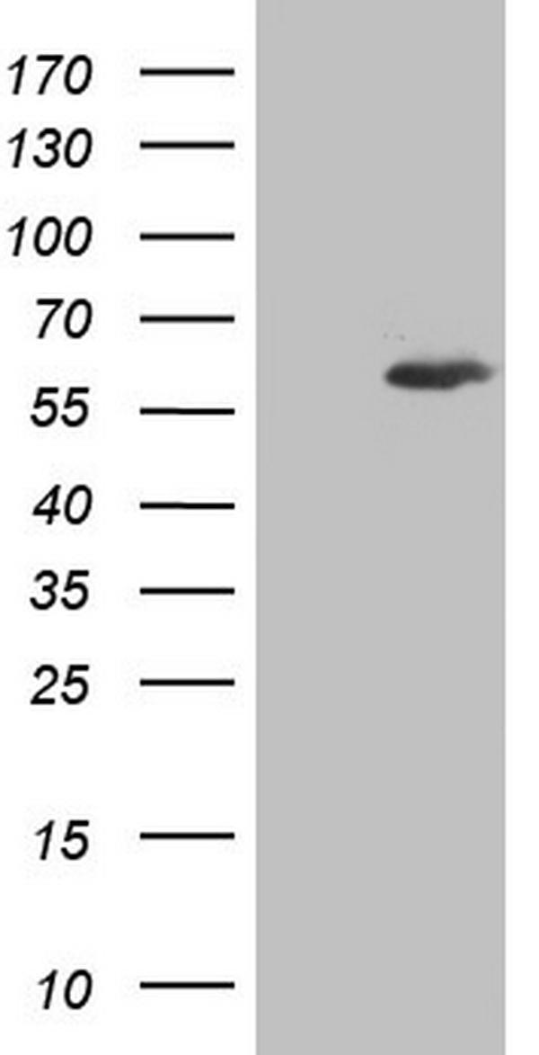 IKZF3 / AIOLOS Antibody - HEK293T cells were transfected with the pCMV6-ENTRY control (Left lane) or pCMV6-ENTRY IKZF3 (Right lane) cDNA for 48 hrs and lysed. Equivalent amounts of cell lysates (5 ug per lane) were separated by SDS-PAGE and immunoblotted with anti-IKZF3.