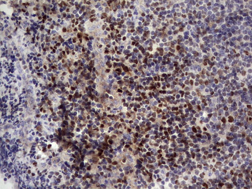 IKZF3 / AIOLOS Antibody - IHC of paraffin-embedded Human tonsil using anti-IKZF3 mouse monoclonal antibody. (Heat-induced epitope retrieval by 1 mM EDTA in 10mM Tris, pH8.5, 120°C for 3min).