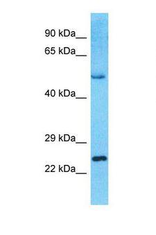 IKZF3 / AIOLOS Antibody - Western blot of Human Lymph Node Tumor. IKZF3 antibody dilution 1.0 ug/ml.  This image was taken for the unconjugated form of this product. Other forms have not been tested.
