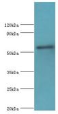 IKZF3 / AIOLOS Antibody - Western blot. All lanes: Zinc finger protein Aiolos antibody at 8 ug/ml+HepG2 whole cell lysate. Secondary antibody: Goat polyclonal to rabbit at 1:10000 dilution. Predicted band size: 58 kDa. Observed band size: 58 kDa.