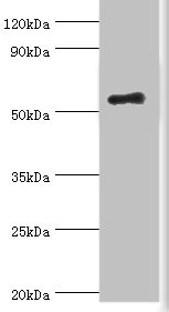 IKZF3 / AIOLOS Antibody - Western blot All lanes: Zinc finger protein Aiolos antibody at 8µg/ml + HepG2 whole cell lysate Secondary Goat polyclonal to rabbit IgG at 1/10000 dilution Predicted band size: 59, 52, 54, 30, 48, 50, 55, 42, 36, 33, 43, 31 kDa Observed band size: 59 kDa