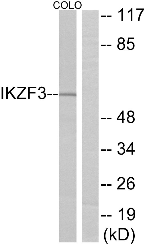 IKZF3 / AIOLOS Antibody - Western blot analysis of lysates from COLO cells, using IKZF3 Antibody. The lane on the right is blocked with the synthesized peptide.