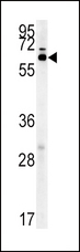 IKZF3 / AIOLOS Antibody - IKZF3 Antibody western blot of mouse liver tissue lysates (15 ug/lane). The IKZF3 antibody detected IKZF3 protein (arrow).