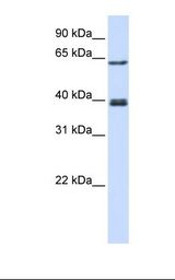 IKZF3 / AIOLOS Antibody - Transfected 293T cell lysate. Antibody concentration: 1.0 ug/ml. Gel concentration: 12%.  This image was taken for the unconjugated form of this product. Other forms have not been tested.