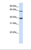 IKZF3 / AIOLOS Antibody - Transfected 293T cell lysate. Antibody concentration: 1.0 ug/ml. Gel concentration: 12%.  This image was taken for the unconjugated form of this product. Other forms have not been tested.