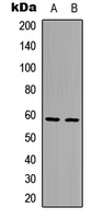 IKZF3 / AIOLOS Antibody - Western blot analysis of AIOLOS expression in HepG2 (A); HeLa (B) whole cell lysates.
