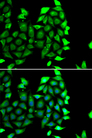 IKZF3 / AIOLOS Antibody - Immunofluorescence analysis of MCF7 cells.