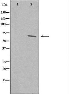 IKZF3 / AIOLOS Antibody - Western blot analysis of extracts of COLO cells using IKZF3 antibody. The lane on the left is treated with the antigen-specific peptide.