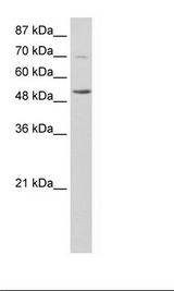 IKZF3 / AIOLOS Antibody - HepG2 Cell Lysate.  This image was taken for the unconjugated form of this product. Other forms have not been tested.
