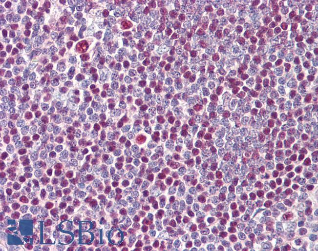 IKZF3 / AIOLOS Antibody - Anti-IKZF3 / AIOLOS antibody IHC of human tonsil. Immunohistochemistry of formalin-fixed, paraffin-embedded tissue after heat-induced antigen retrieval. Antibody dilution 5-10 ug/ml. This image was taken for the unconjugated form of this product. Other forms have not been tested.